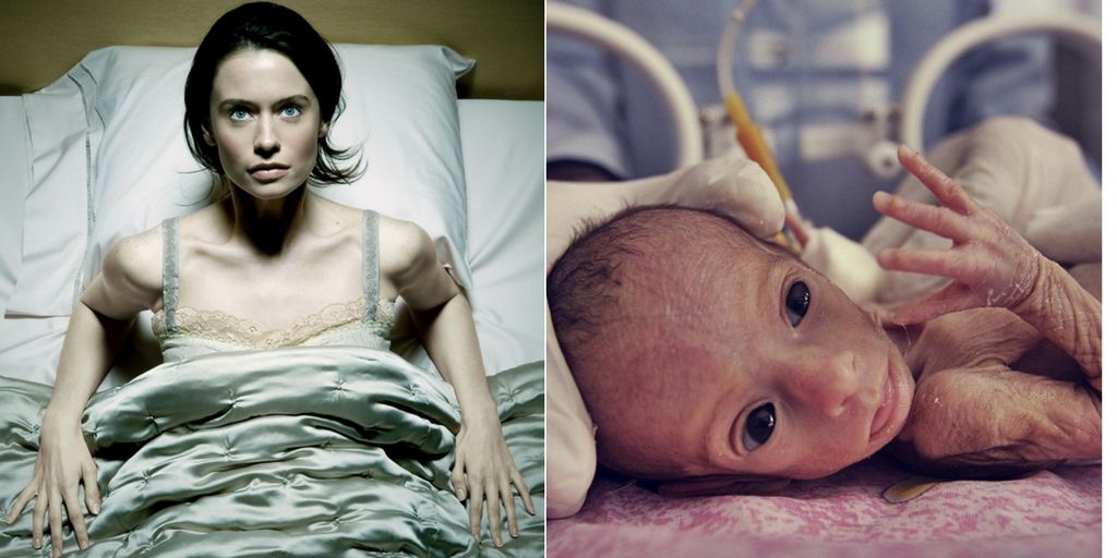 bed rest during pregnancy