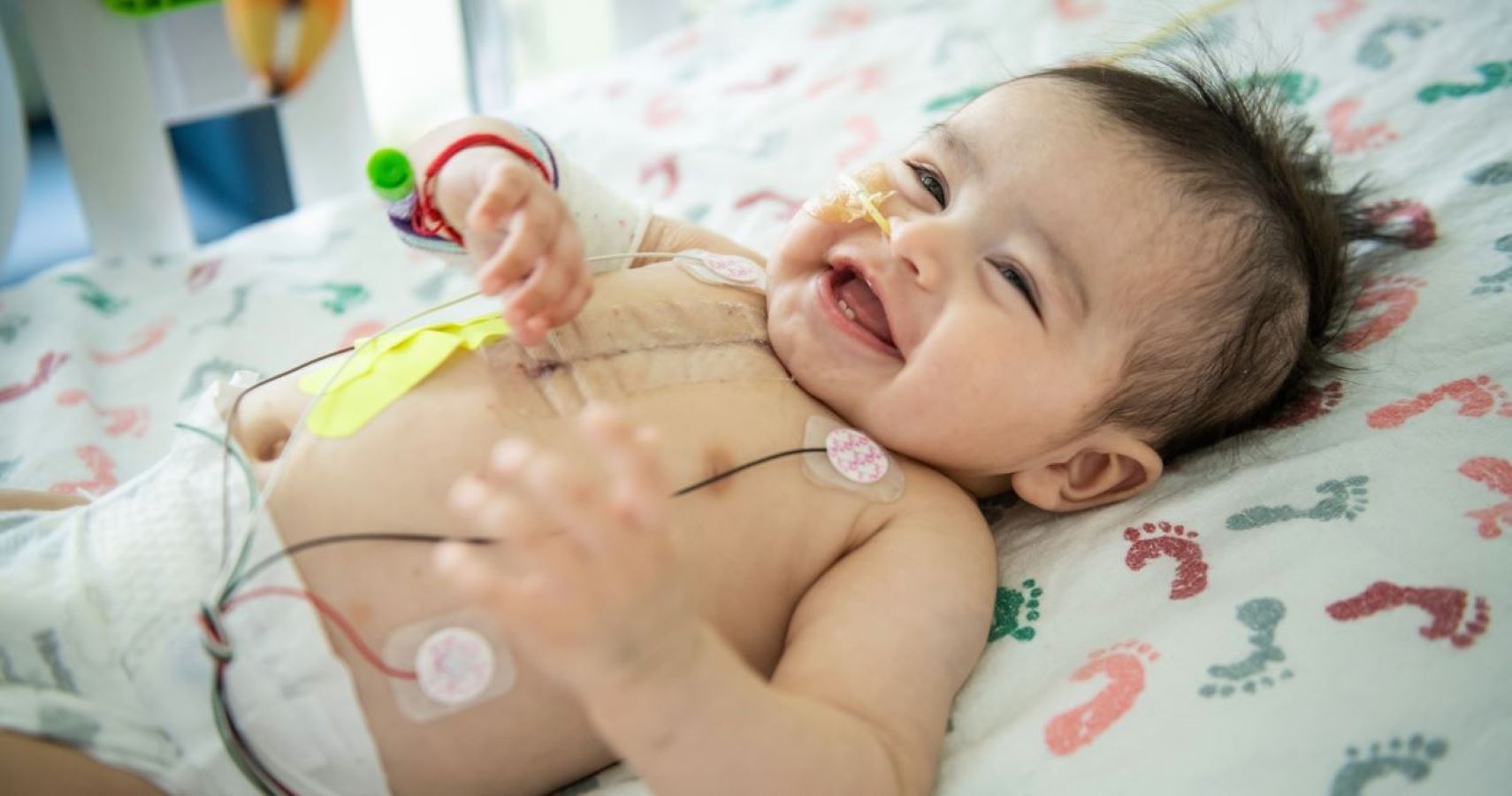 Incredible Baby 300th Heart Transplant Survivor at